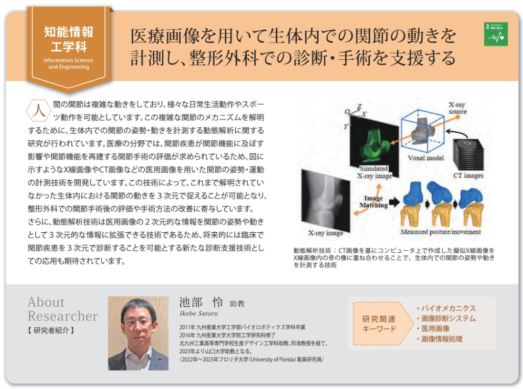 医療画像を用いて生体内での関節の動きを計測し、整形外科での診断・手術を支援する（池部怜助教）